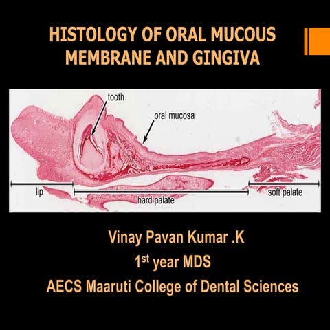 Histology of oral mucous membrane and gingiva