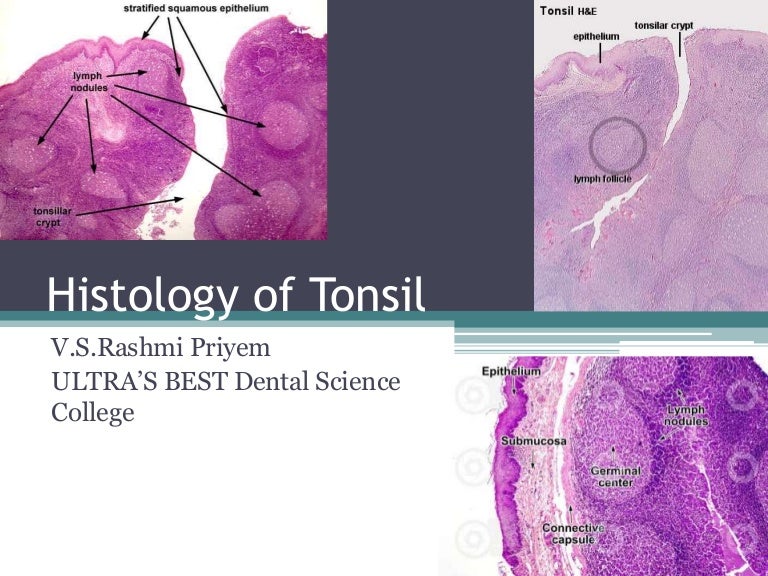 Histology of Tonsil