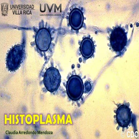 Histoplasma Capsulatum