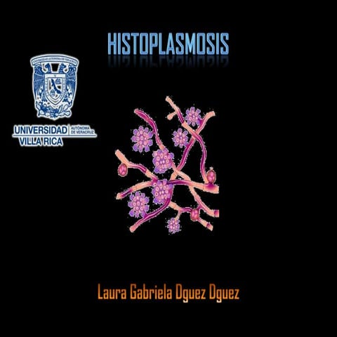 Histoplasmosis