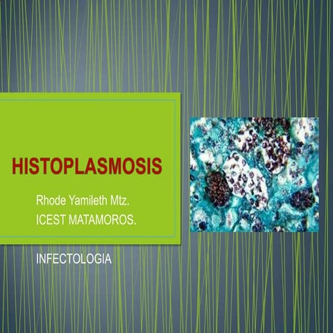 Histoplasmosis