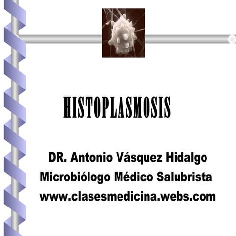 Histoplasmosis 