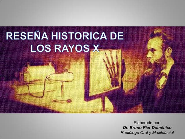 Historia de los Rx