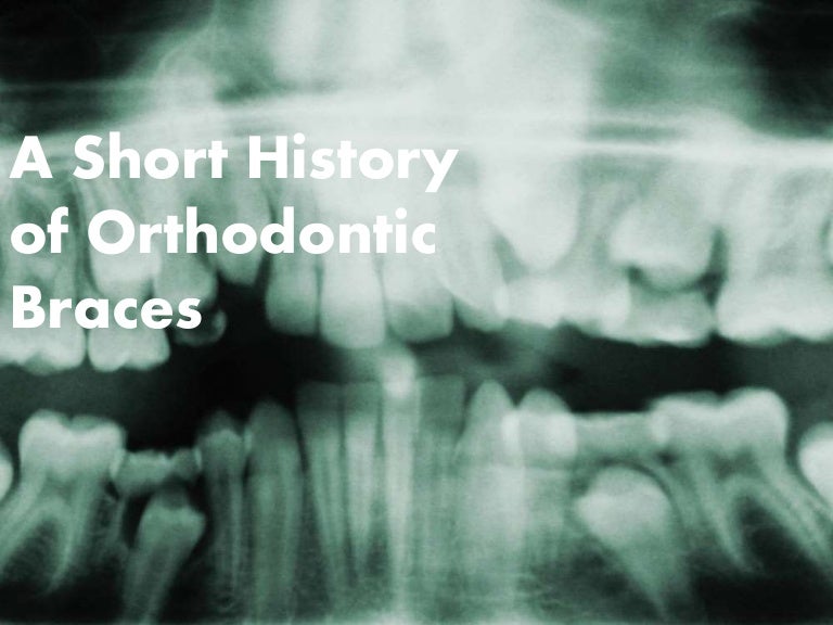 A Short History of Orthodontic Braces