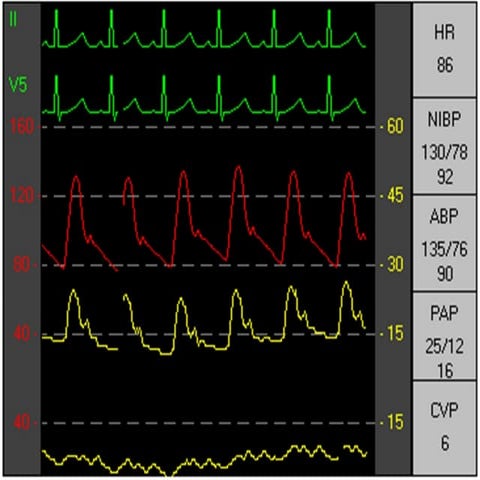 HM.pptxjjyyyyuuyhuhhhhhhhhyttrddddddtyhjjutrrr