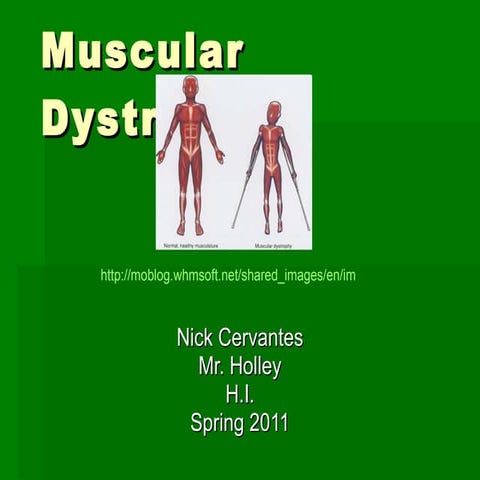 Muscular dystrophy | PPTX