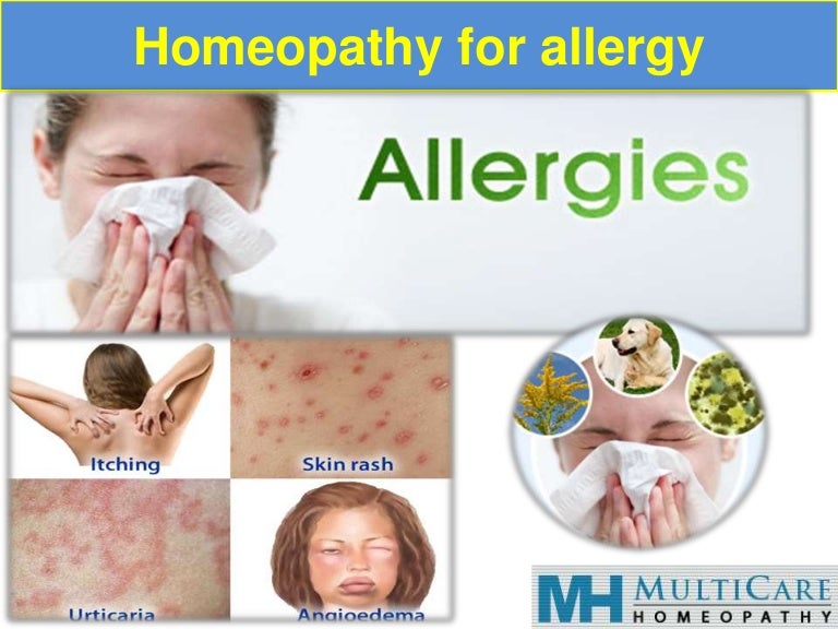 Homeopathy for Allergy.