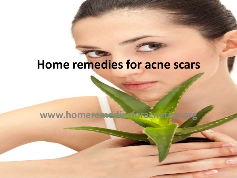 home remedies to fade acne scars