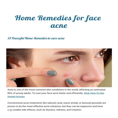 Top 12 Home Remedies for Acne - Dr. Axe