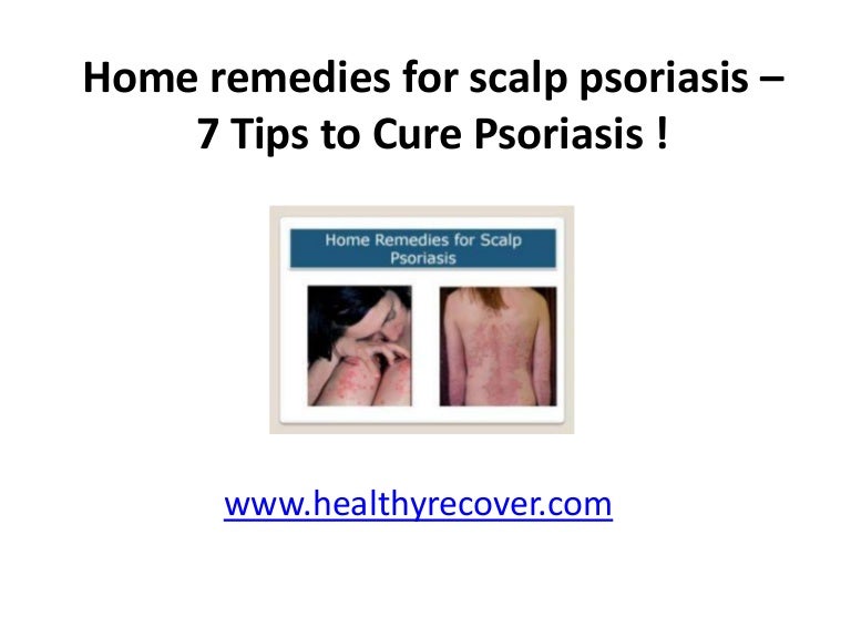 home remedies for psoriasis on my scalp