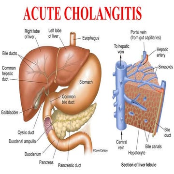 Khuyến cáo Tokyo 2018 - Chẩn đoán và xử trí viêm đường mật cấp