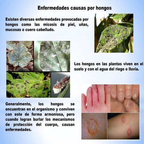 Enfermedades Causadas Por Los Hongos