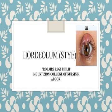 Stye | PPTX