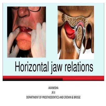 horizontal jaw relation.pptx