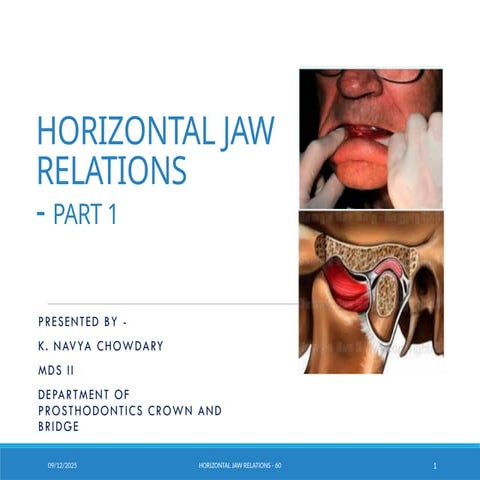 HORIZONTAL JAW RELATIONS IN PROSTHODONTICS