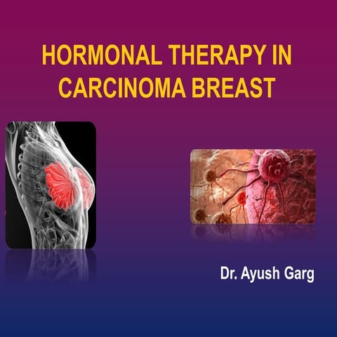 Hormonal therapy in breast cancer