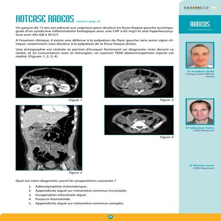 Hotcase Radeos | PDF