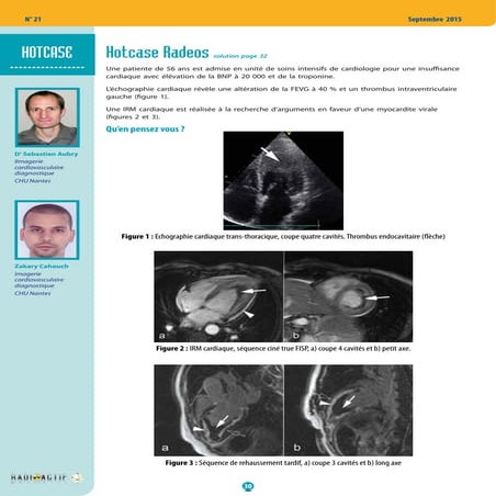 Comprehensive Cardiac MRI Techniques and Clinical Applications | PDF