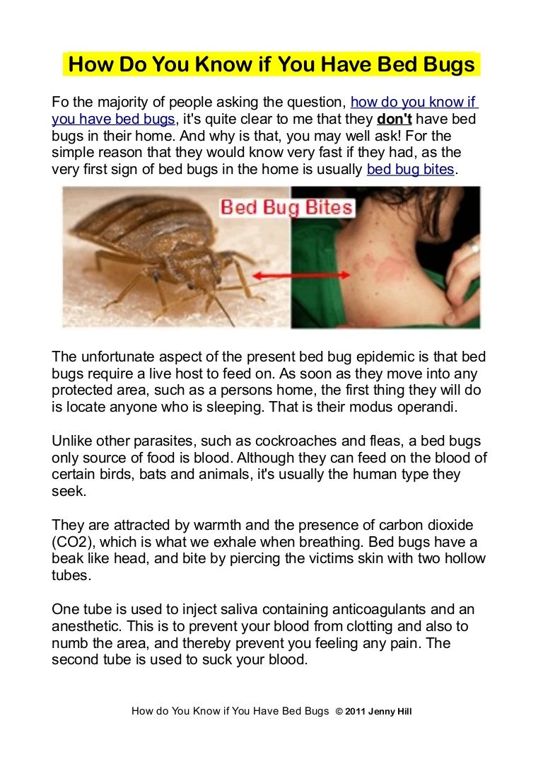 How Do You Know If You Have Bed Bugs How Do You Know If You Have Bed Bugs