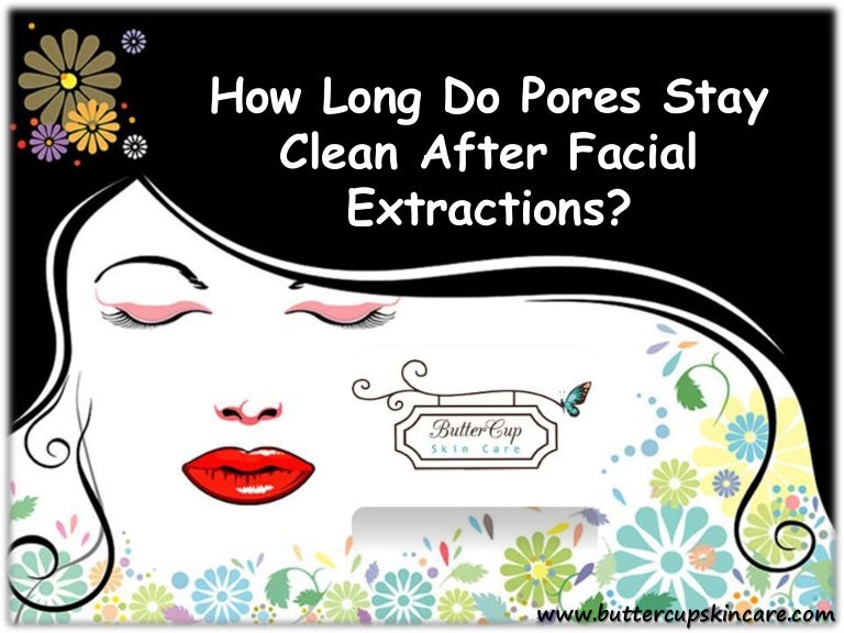 How Long Do Pores Stay Clean After Facial Extractions