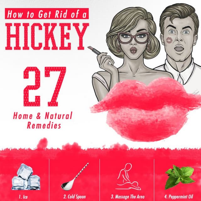 How to Get Rid of a Hickey Infographic PDF
