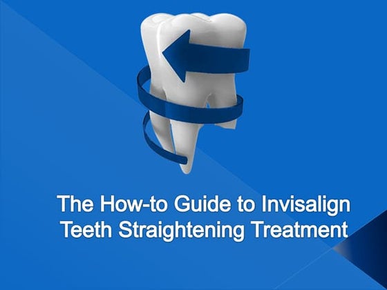 Invisalign vs. Braces: A Comprehensive Guide to Making the Right Choice ...