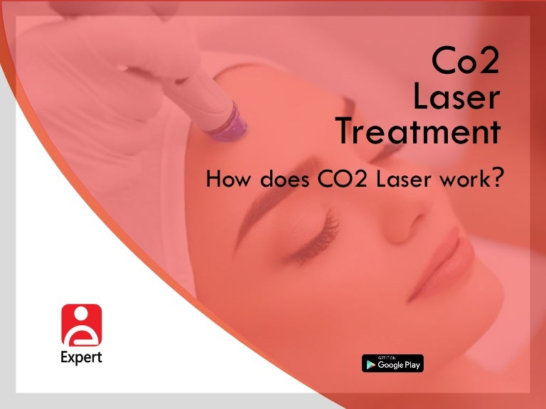 How CO2 Laser Treatment Work?