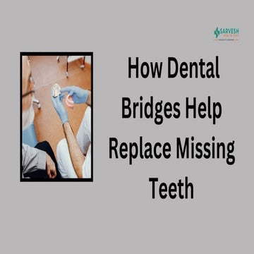 How Dental Bridges Help Replace Missing Teeth.pdf