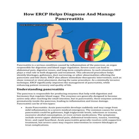 Ercp | PPTX