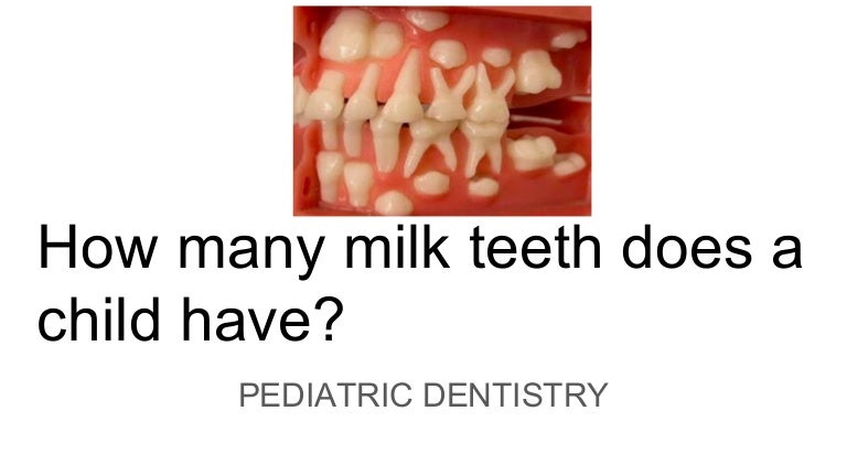 How many milk teeth does a child have (1)