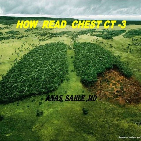 How  read  chest ct  3