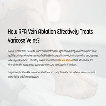 How RFA Vein Ablation Effectively Treats Varicose Veins? | PDF