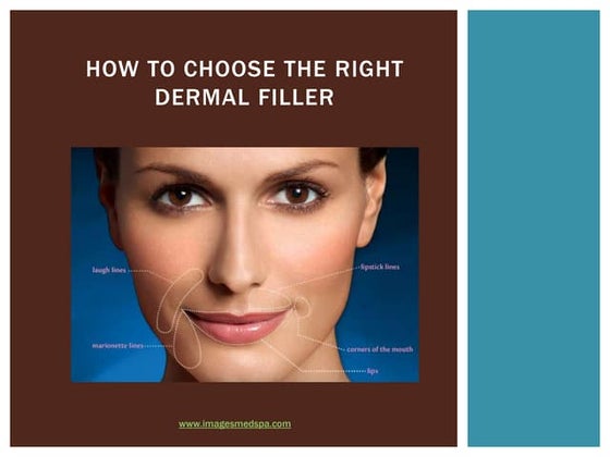 Juvederm brochure 8 points lift | PDF | Skin Care | Beauty