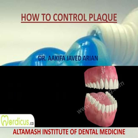 How to control plaque