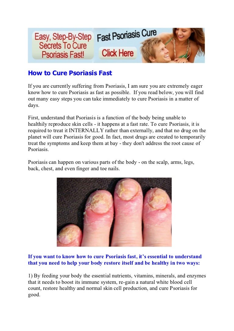 natural treatment for psoriasis psoriasis treatment natural