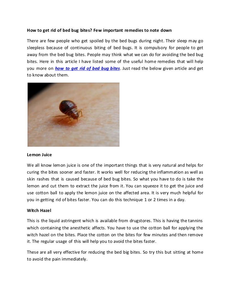 bed bug bite remedies