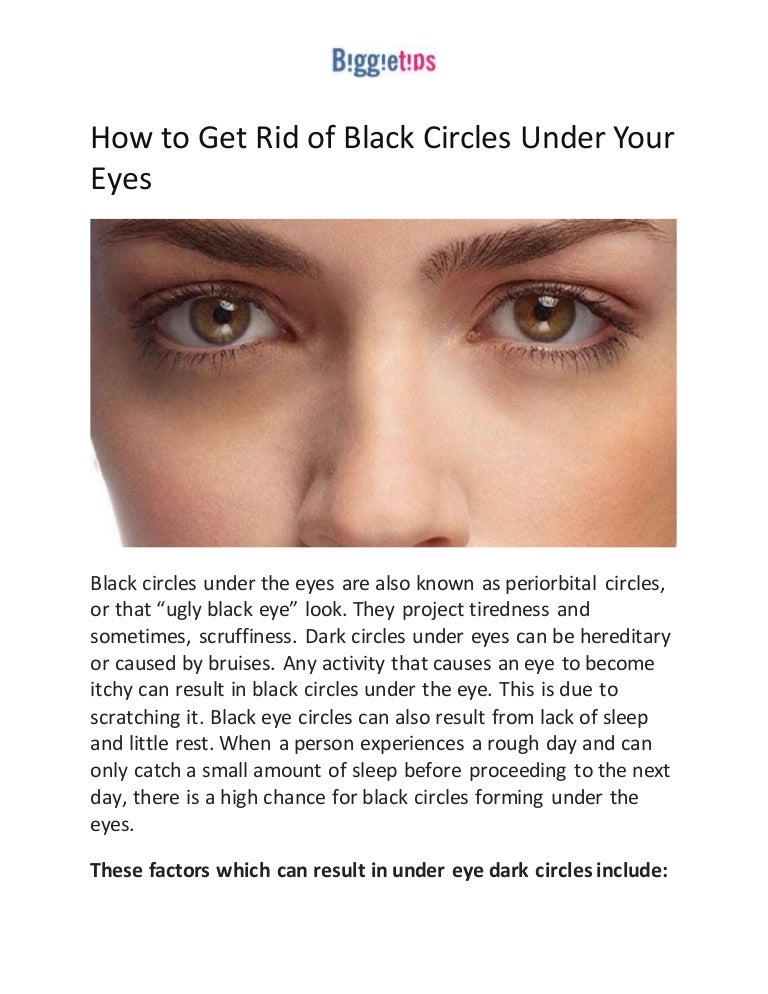 How to get rid of black circles under your eyes