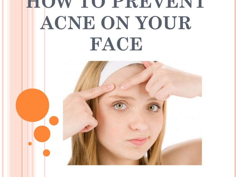 How to prevent acne on your face