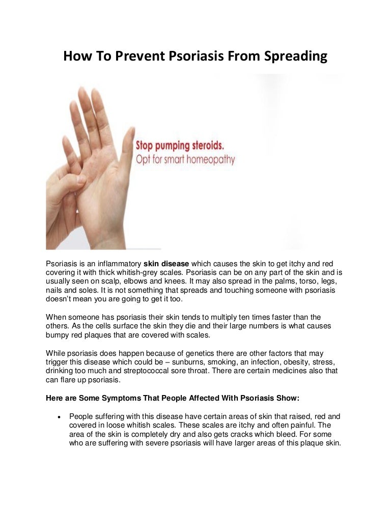 How to prevent psoriasis from spreading