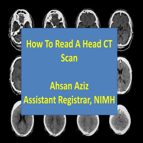 How To Read A Head CT Scan 