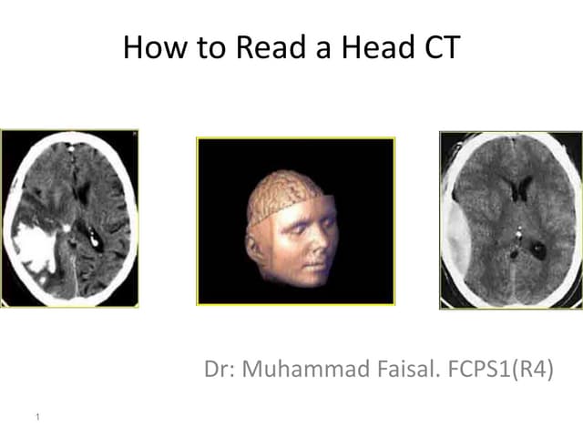 Baca Ct Scan Nr 1 Pptx