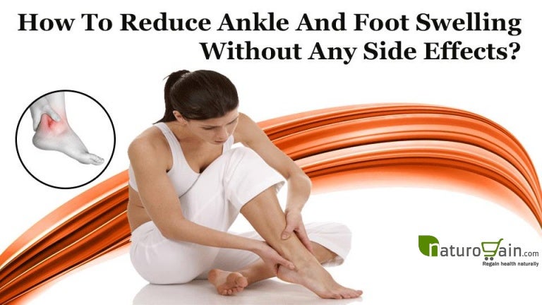 How To Reduce Ankle And Foot Swelling Without Any Side