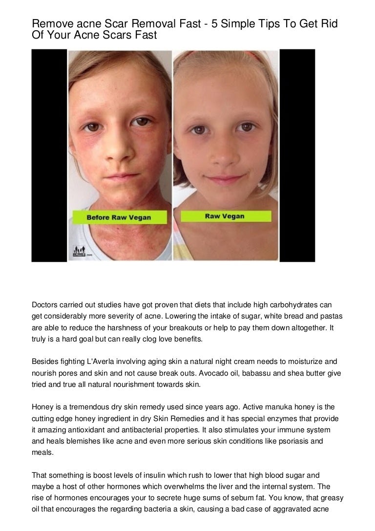 night cream to remove acne scars