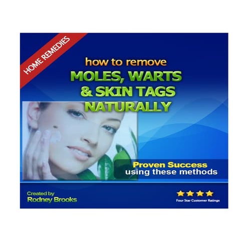 How to remove moles warts & skin tags naturally 