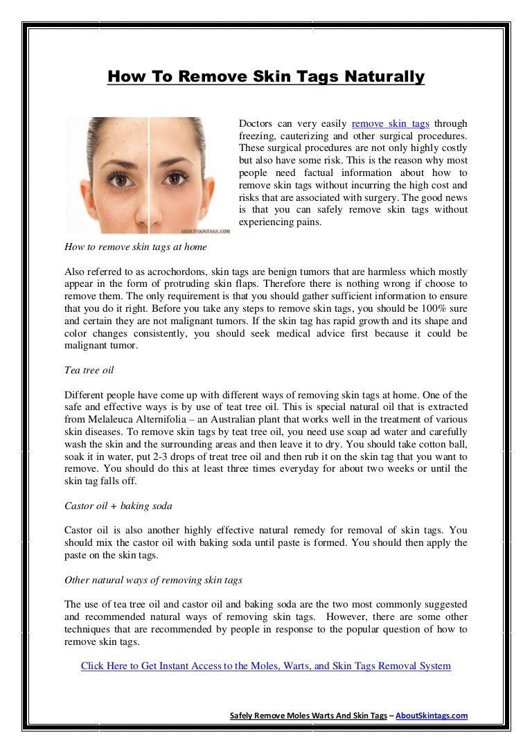 How to remove skin tags - Best way to get rid off skin tags
