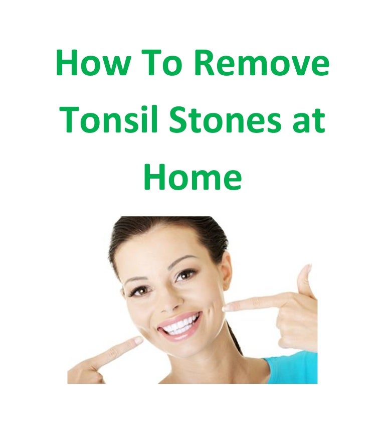 How To Remove Tonsil Stones At Home In Hindi HOWTORMEOV
