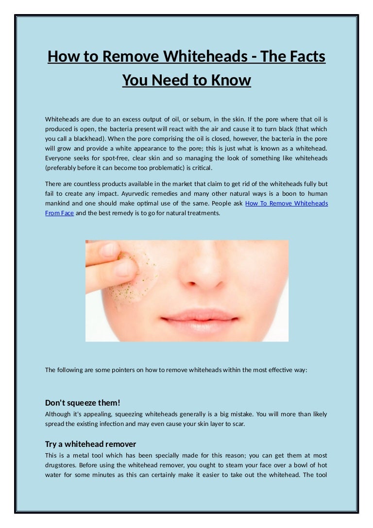How to remove whiteheads the facts you need to know