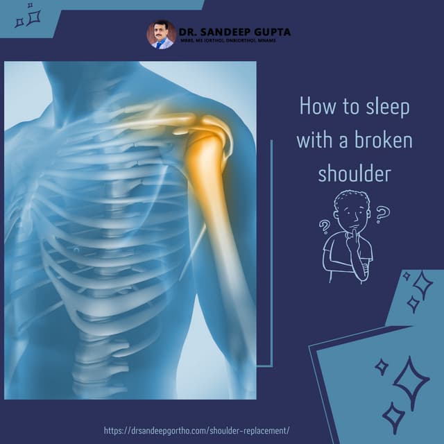How to sleep with a broken shoulder.pdf