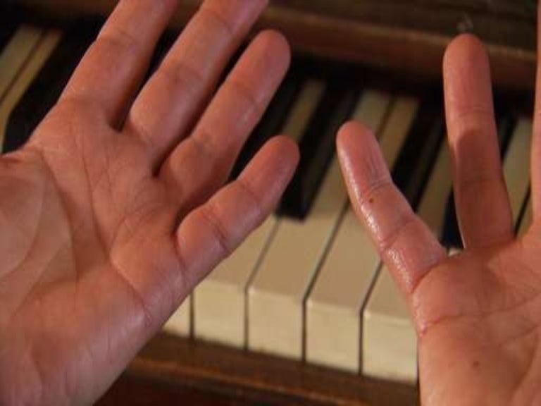 How To Stop Sweaty Hands