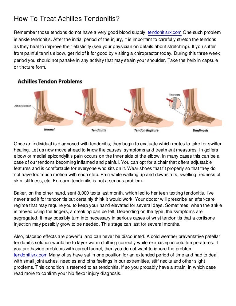 How To Treat Achilles Tendonitis_